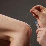 dry needle knee